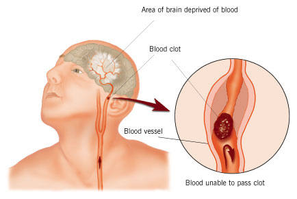 The Molecular Basis of Fibrin Clot Elasticity