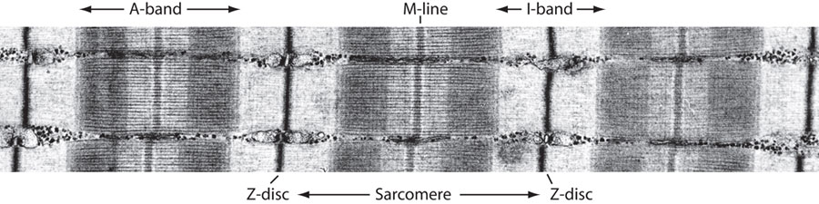 Muscle Longitudinal View; musclong1